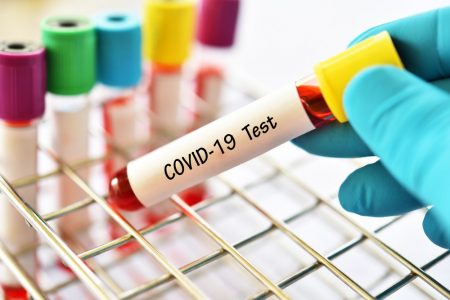16 летальных случаев и 608 заболевших: COVID-19 в Запорожской области